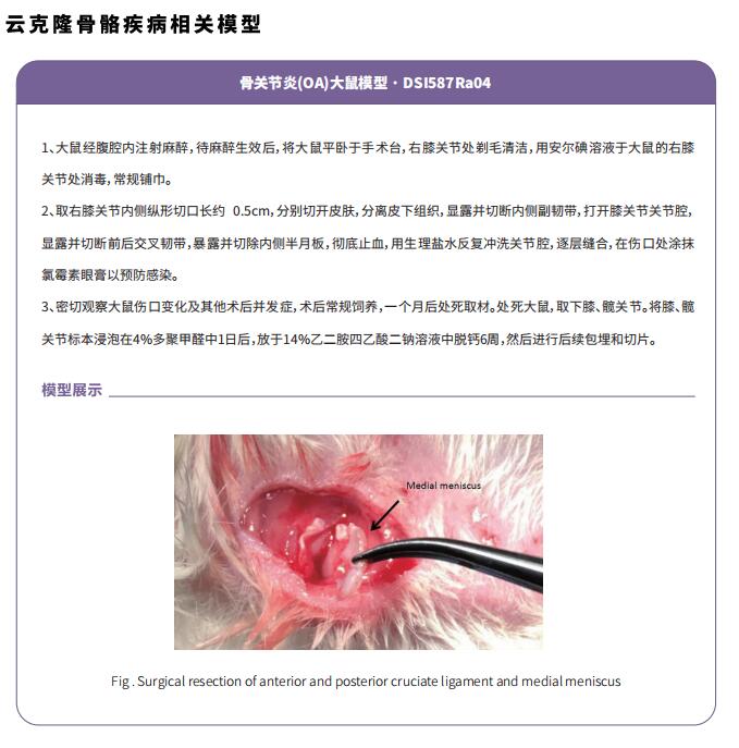 文献解读 | 细胞外核糖核酸对骨关节炎神经血管形成的影响