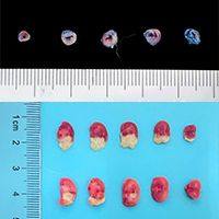 脑梗MCAO、心梗MI、主动脉弓缩窄TAC批量化模型