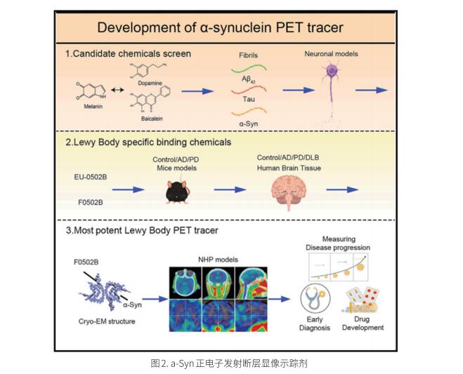 帕金森潜在治疗方法研究新发现