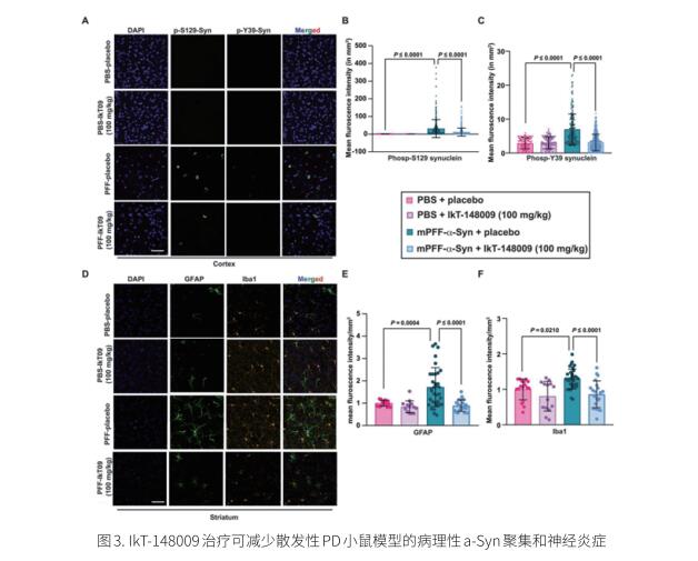 帕金森潜在治疗方法研究新发现