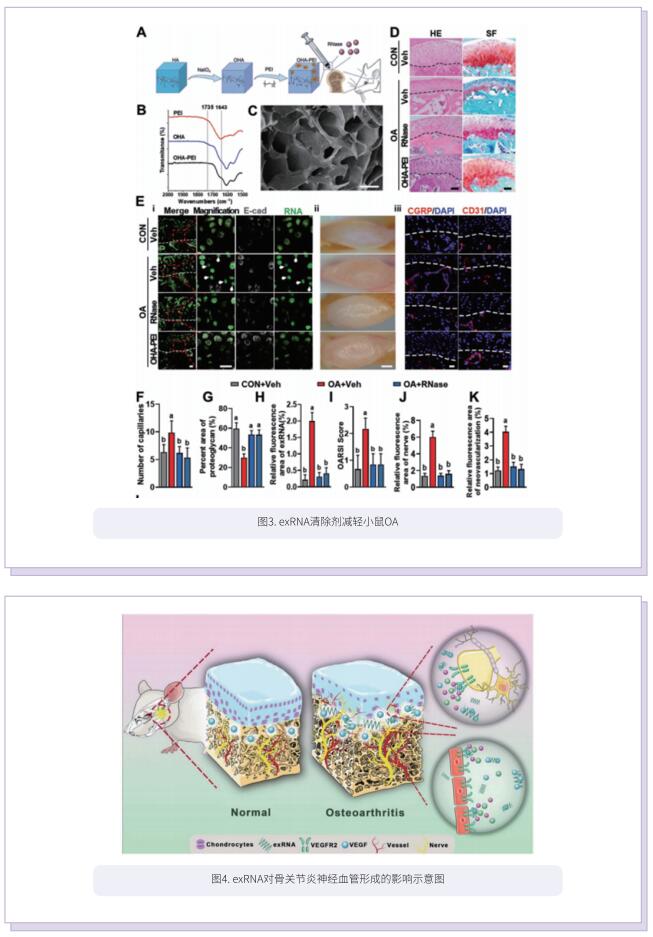 文献解读 | 细胞外核糖核酸对骨关节炎神经血管形成的影响