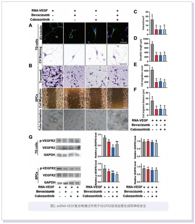 文献解读 | 细胞外核糖核酸对骨关节炎神经血管形成的影响