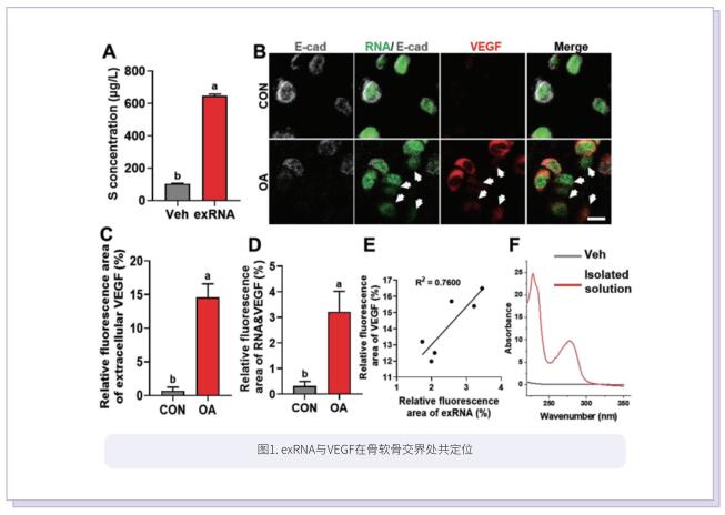 文献解读 | 细胞外核糖核酸对骨关节炎神经血管形成的影响