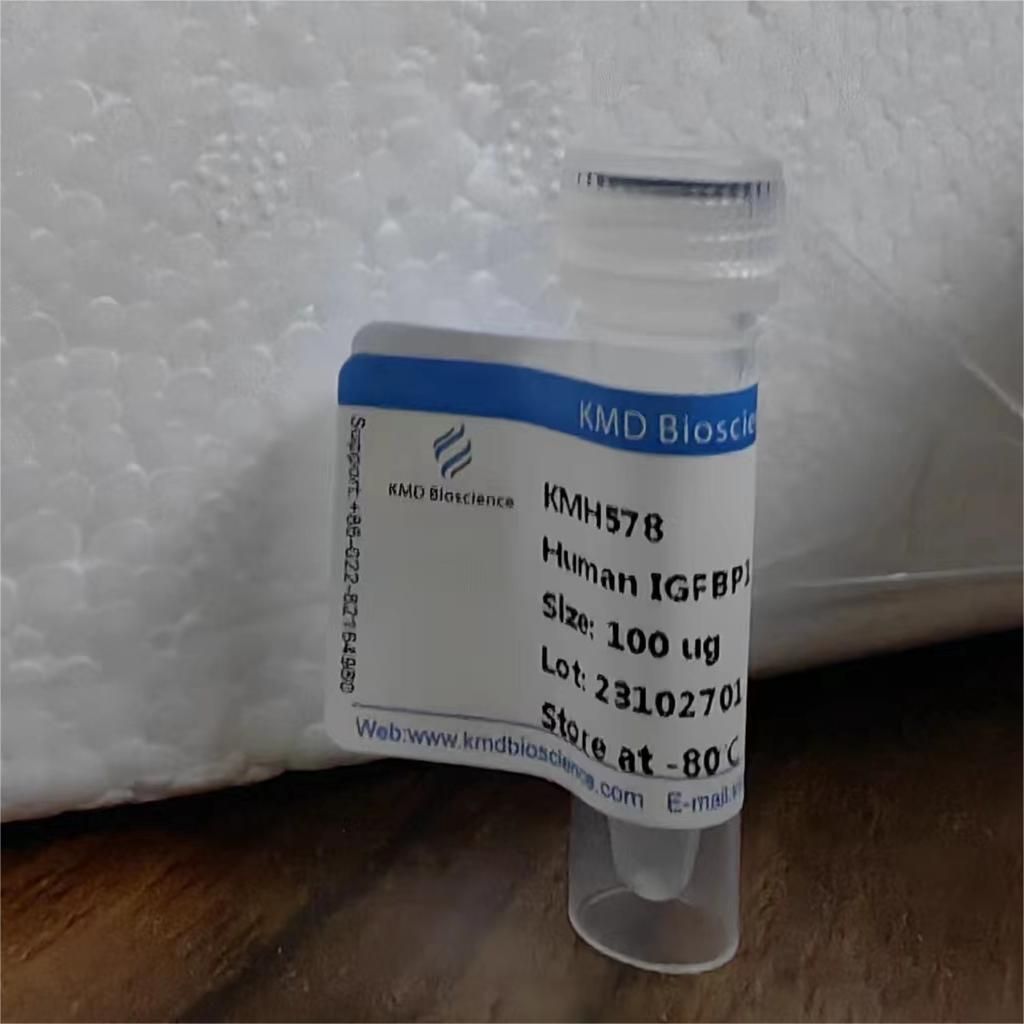 Recombinant Human IGFBP1 Protein, His Tag