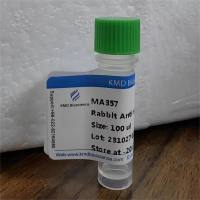 Rabbit Anti-Human CD27 mAb