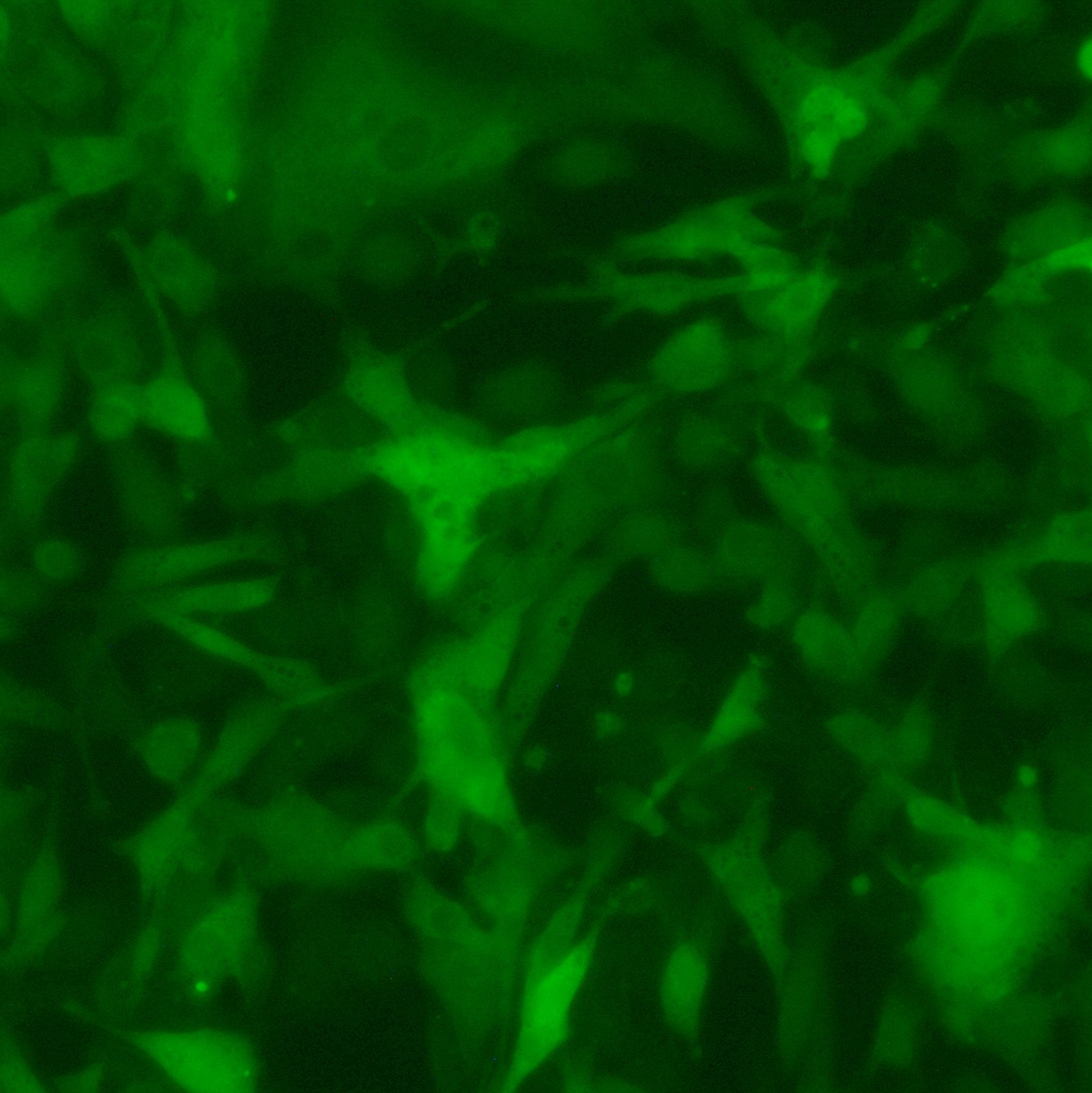 B16-F10-LUC-GFP-Puro【B16F10-LUC;B16F10-GFP】萤火虫荧光素酶标记的小鼠皮肤黑色素瘤细胞