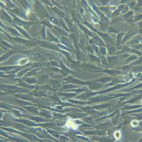 HUASMC-T[huasmc]永生化人脐动脉平滑肌细胞