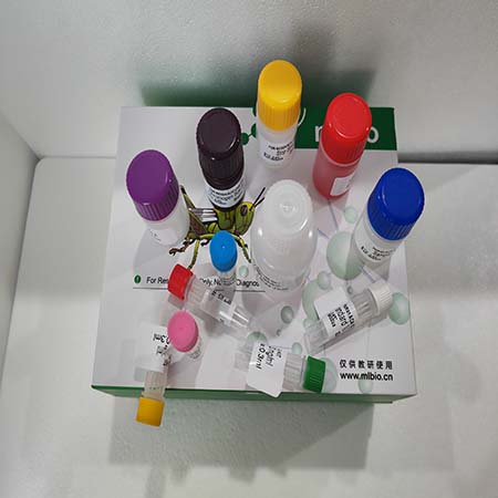 小鼠抗酒石酸酸性磷酸酶5b(TRACP-5b)ELISA试剂盒的自动化应用