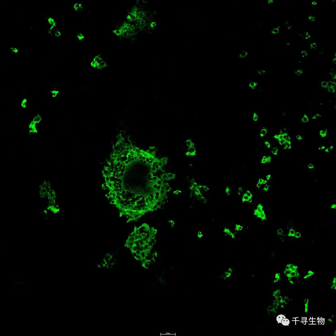 引起仔猪腹泻的5种病毒（PEDV、PDCOV、TGEV、SADS、PoRV）单抗与蛋白、核酸、阳性血清上市啦