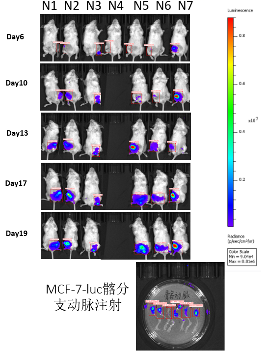 CDX人源肿瘤细胞系异体移植小鼠