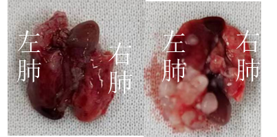 CDX人源肿瘤细胞系异体移植小鼠