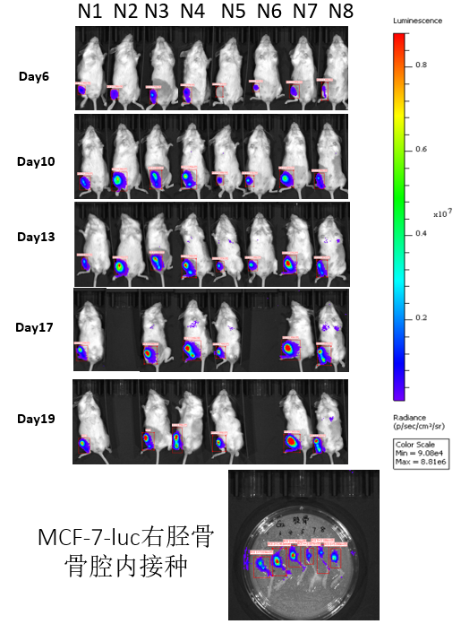 CDX人源肿瘤细胞系异体移植小鼠