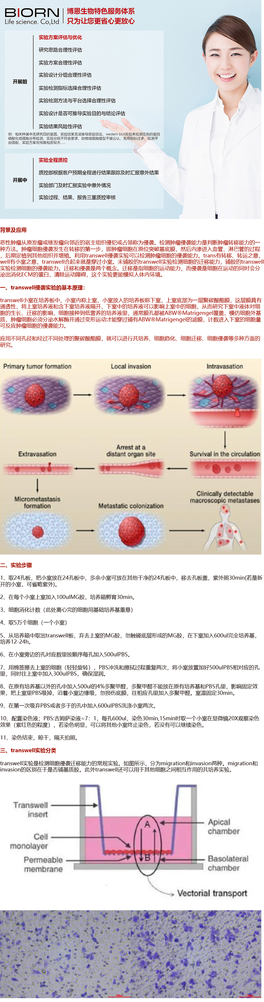 细胞侵袭实验（transwell）