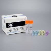 疟原虫（疟原虫属、恶性疟原虫、间日疟原虫、卵形疟原虫、三日疟原虫）核酸检测试剂盒(探针法)