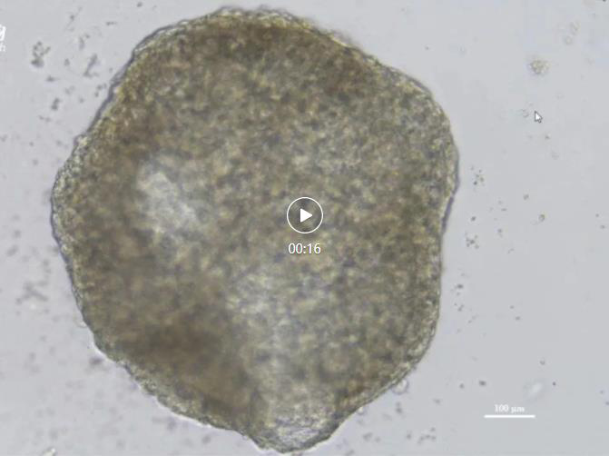 重磅丨环特生物成功构建心脏类器官，助力心脏病药物开发及毒理学研究！