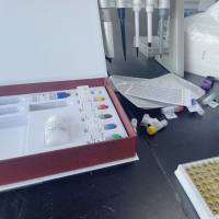 人抗杀菌通透性增高蛋白抗体(BPI-Ab)ELISA试剂盒