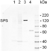 SPS | Sucrose phosphate synthase (maize)