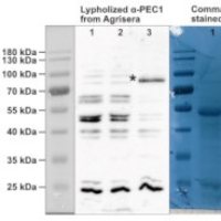 PEC1 | Plastid Envelope Channel 1