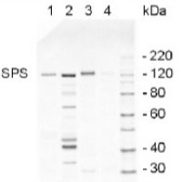 SPS | Sucrose phosphate synthase, global