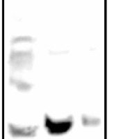 Tic40 | Inner envelope membrane translocon complex protein (chloroplast)