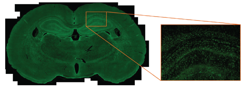 新品发布丨7大特性，5以伦比！DP75显微相机闪亮登场！