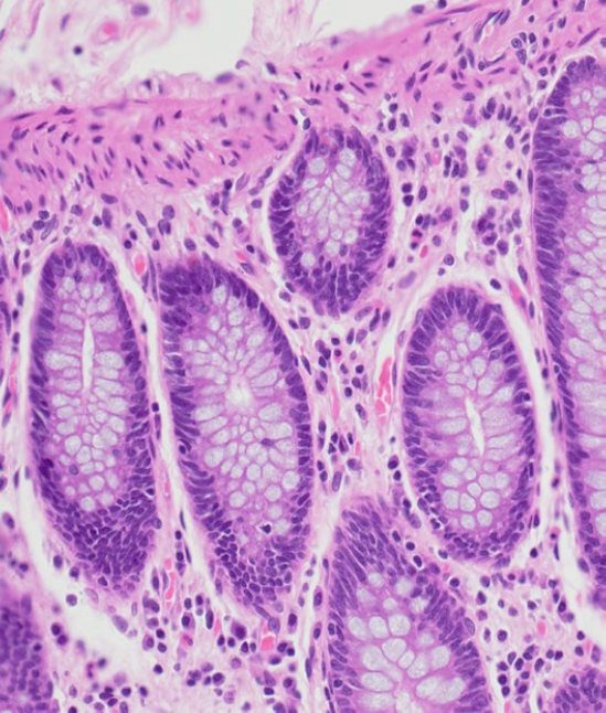 新品发布丨7大特性，5以伦比！DP75显微相机闪亮登场！