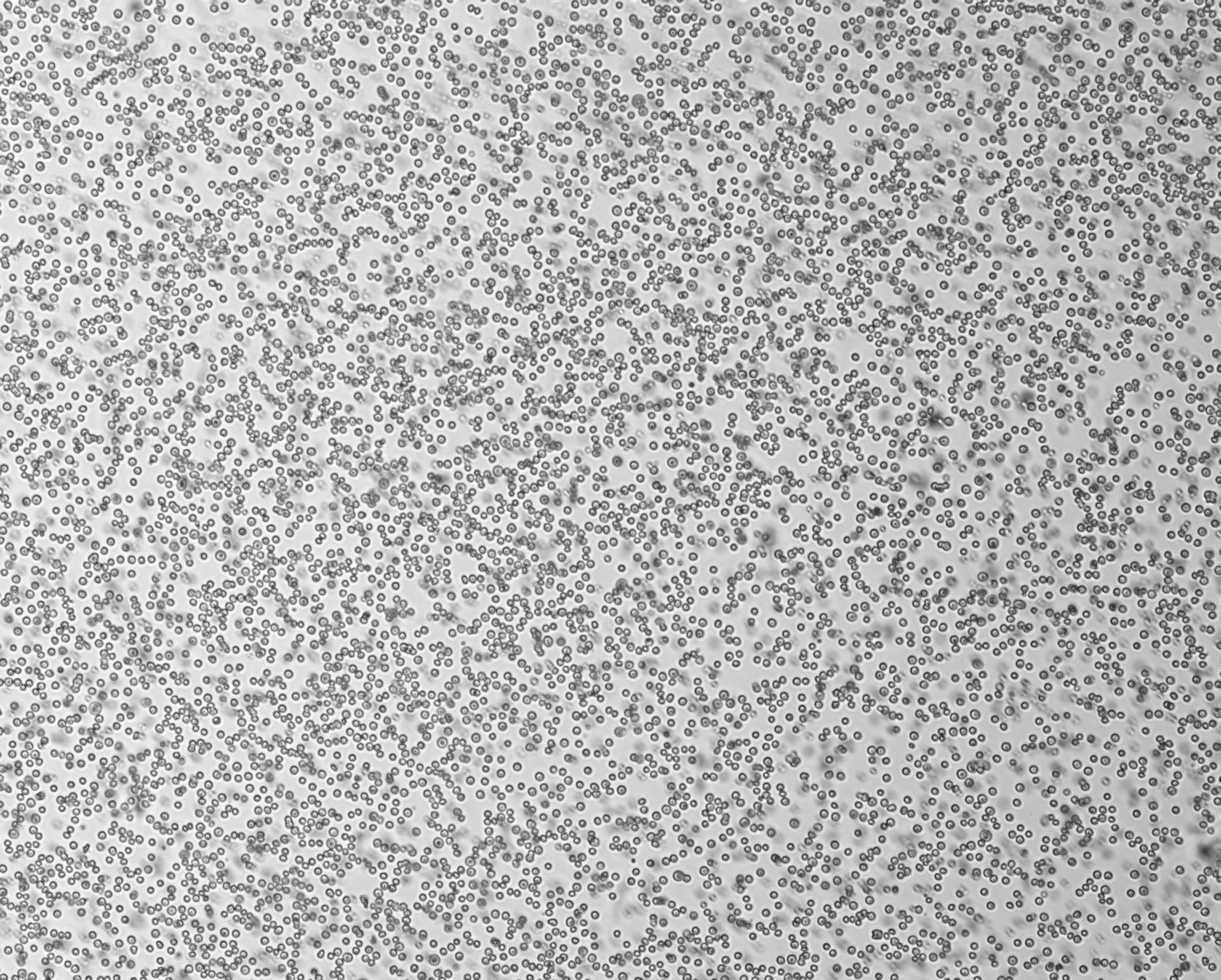 细胞攻略 | HL-60(人原髓细胞白血病细胞)培养教程