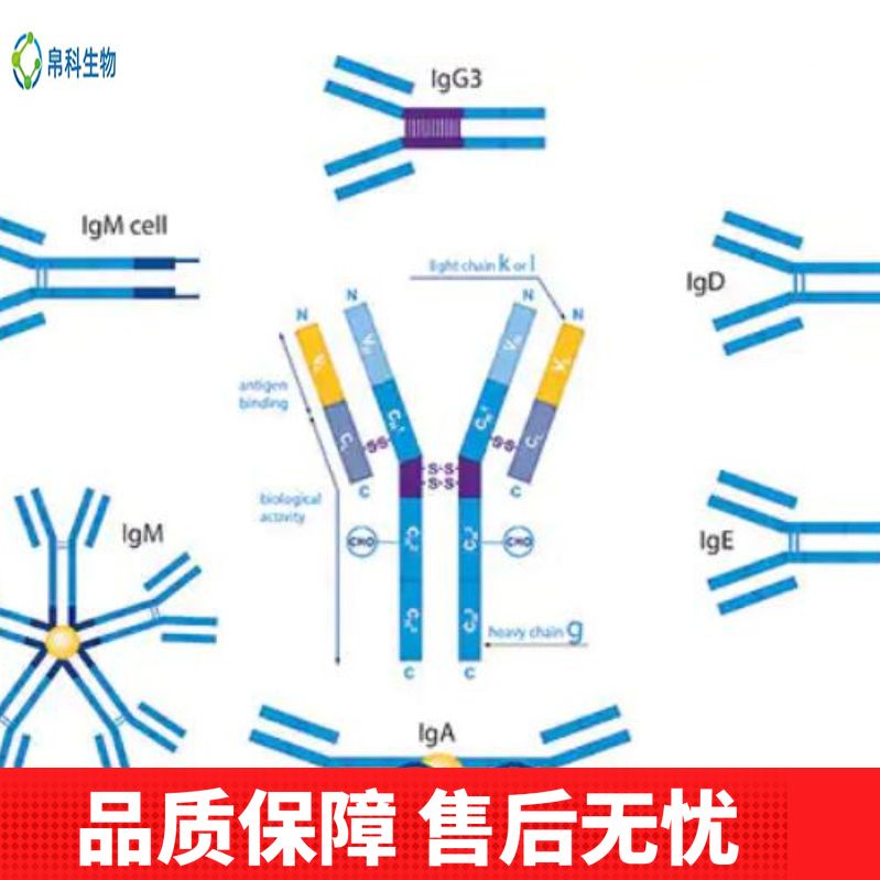 Anti-Factor H/CFH Antibody (Clone#OTI5H5)