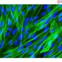 人肺动脉平滑肌细胞 HPASMC (Sciencell进口)