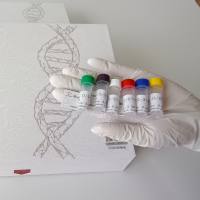 人甲状腺球蛋白(hTG)抗原价格