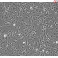 人脑血管平滑肌细胞