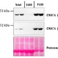 Anti-CNX1/2 | CALNEXIN HOMOLOG 1/2