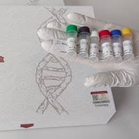 PSA单抗(已配对)价格