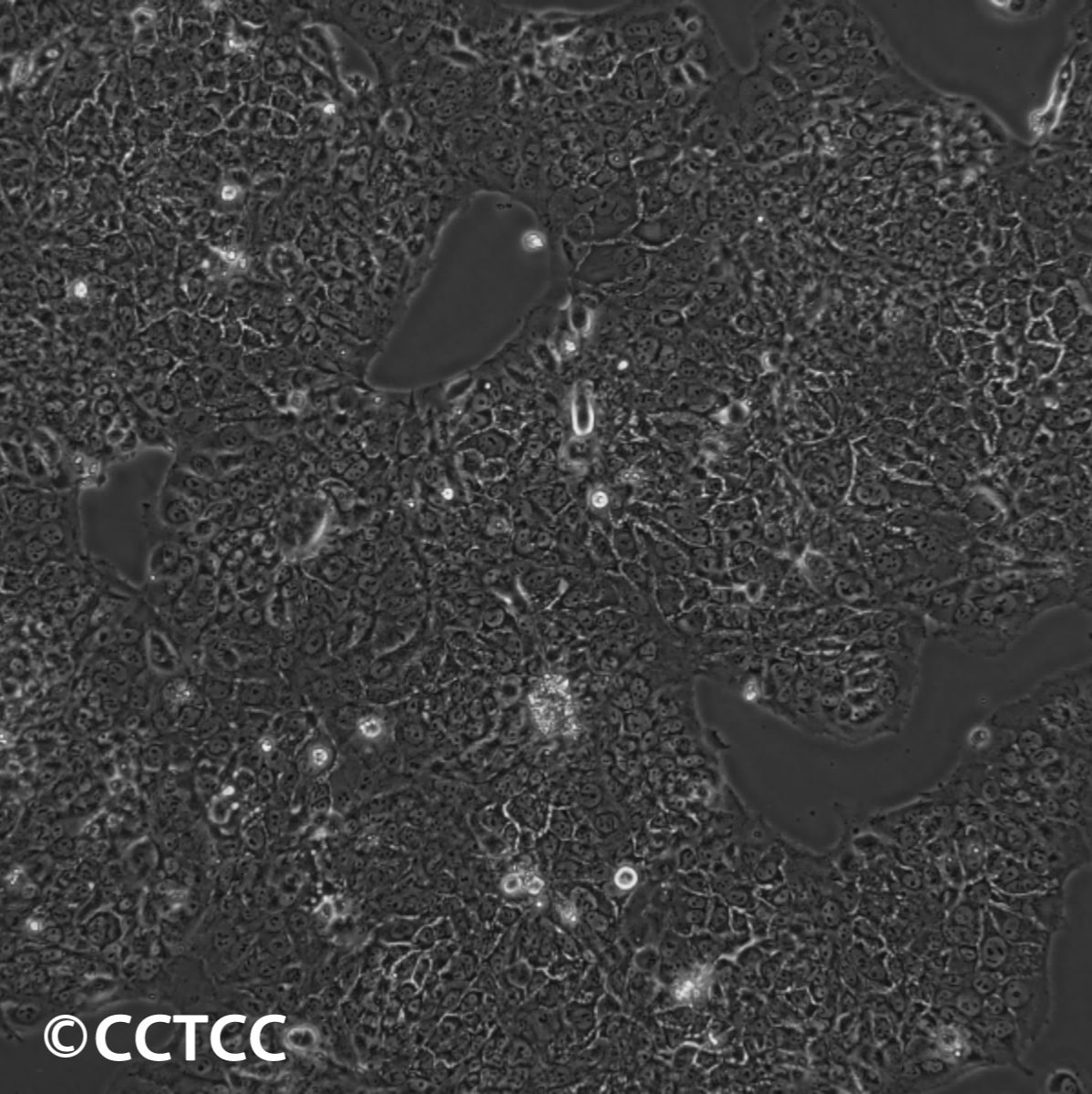 人胎盘绒膜癌细胞(BeWo)（国家细胞资源库供应）CCTCC直发