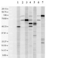 Anti-KDEL | Endoplasmic reticulum retention signal