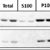 SMT1 | Sterol methyltransferase 1