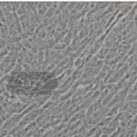 人脐静脉平滑肌细胞