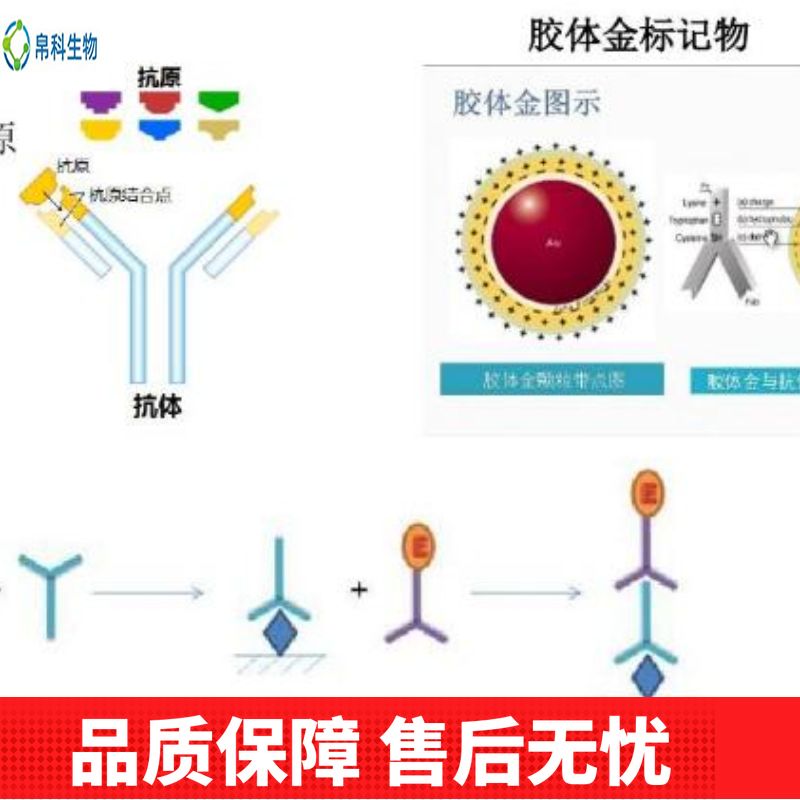 Anti-Human IgA/IGHA1 Antibody (Clone#RM124)