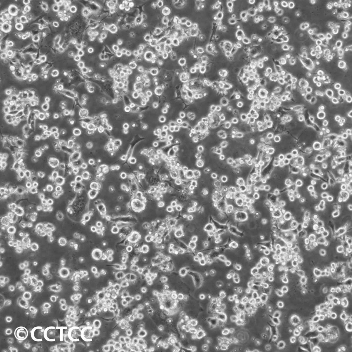 小鼠腹水瘤细胞(S180-S2D9)（国家细胞资源库供应）CCTCC直发