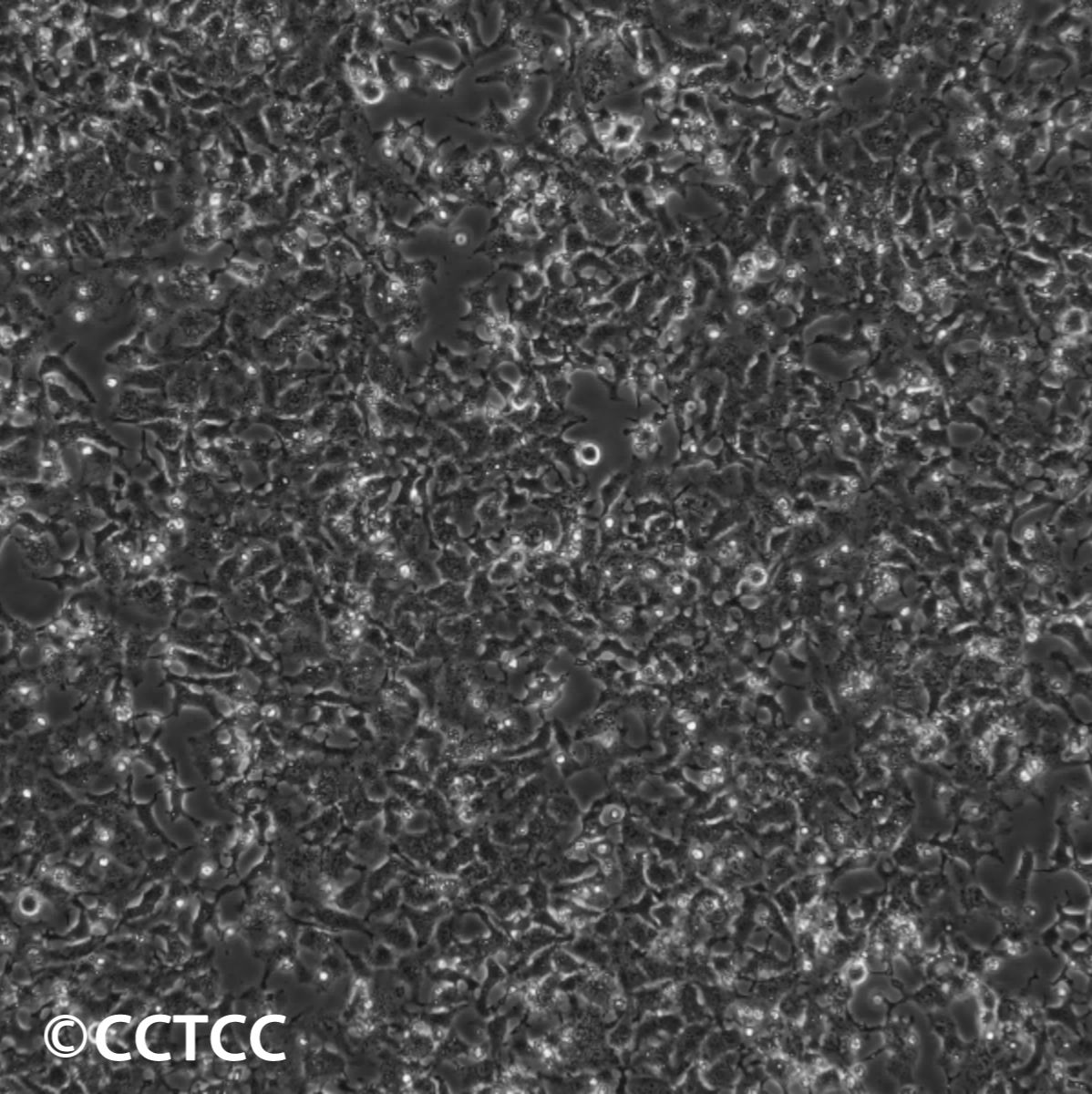 人肝癌细胞(Huh-7.5.1)（国家细胞资源库供应）CCTCC直发