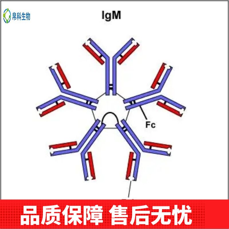 Anti-Vimentin/VIM Antibody (Clone#V9)
