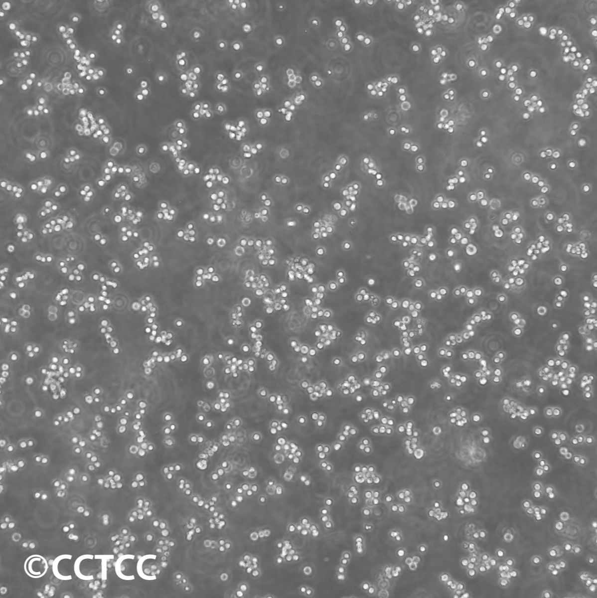 人Burkitts淋巴瘤细胞(Daudi)（国家细胞资源库供应）CCTCC直发