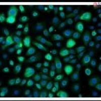 人支气管上皮细胞-成人