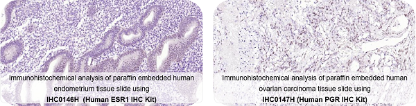 新品上市丨常见肿瘤标志物及其临床意义，只看这一篇就够了！