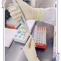 雌二醇放免检测