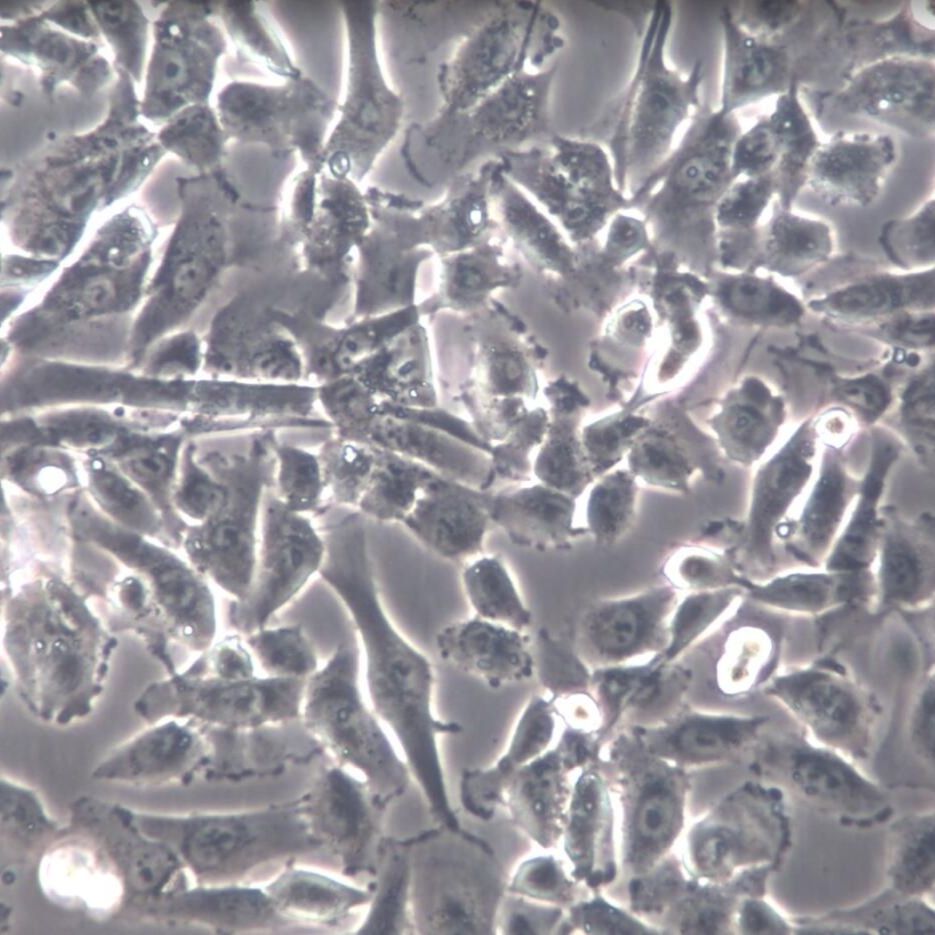 MOG-G-UVW、MOG-G-UVW细胞系、MOG-G-UVW细胞株、MOG-G-UVW人脑星形胶质细胞瘤细胞
