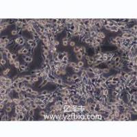 MFC小鼠胃癌细胞