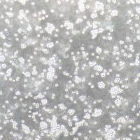 J.gamma1 人急性T细胞白血病细胞/STR鉴定