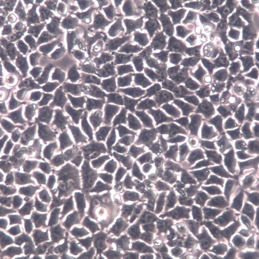 McA-RH7777大鼠肝癌细胞
