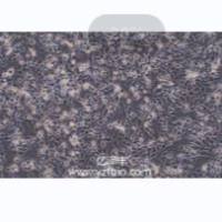 MC38小鼠结肠癌细胞